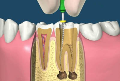 Dental Center Baneasa - clinica stomatologica